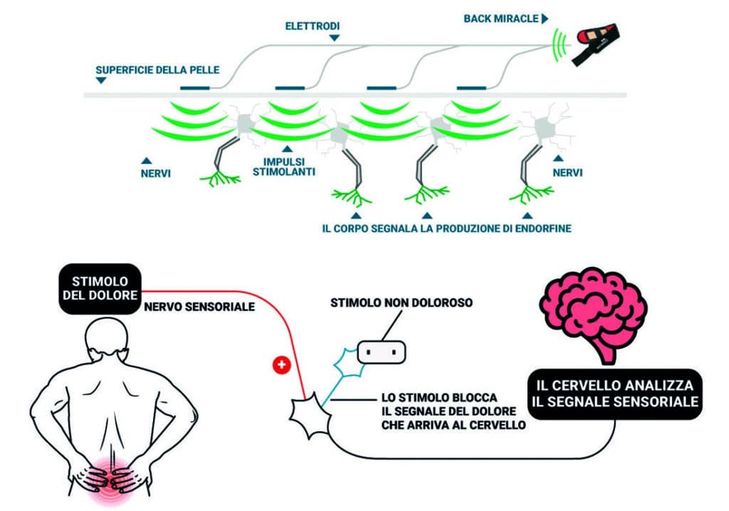 come funziona back miracle
