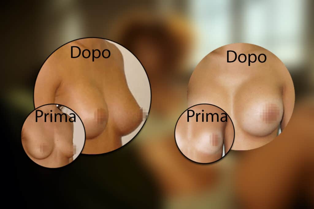 Prima e Dopo con Push Up Formula