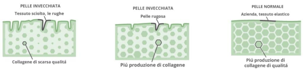 Immagine che mostra la differenza di produzione di collagene tra pelle vecchia e giovane